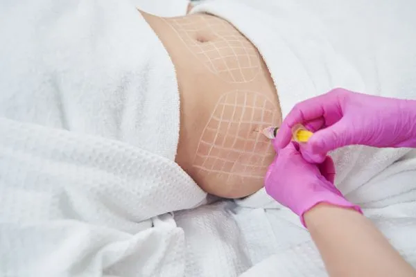 image of fat dissolving injections on love handles to help combat weight gain Allesley Green