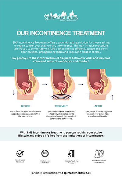 image to show how EMS treatment works for female urinary incontinence Allesley Green
