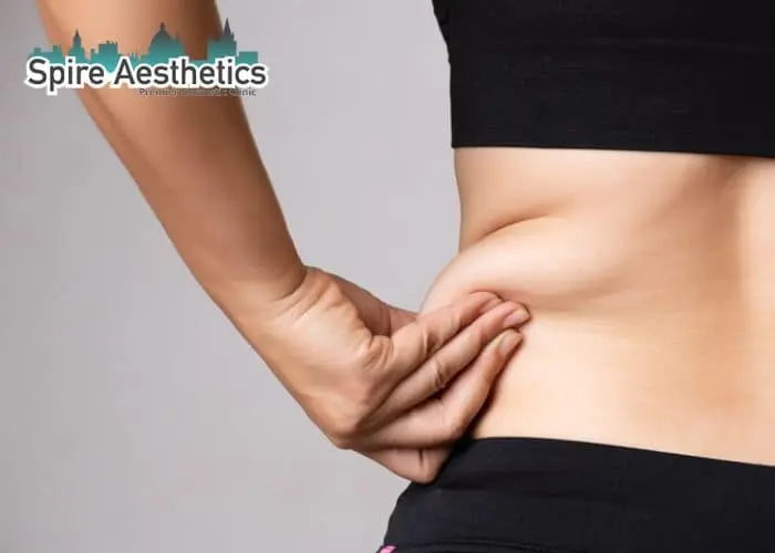 Image of woman pinching fat on their hips Allesley Green. Fat Freezing treatment